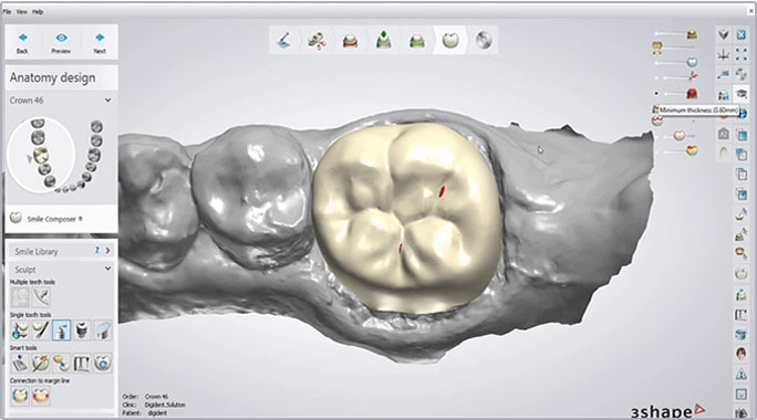 cad-cam-shamsdent-3